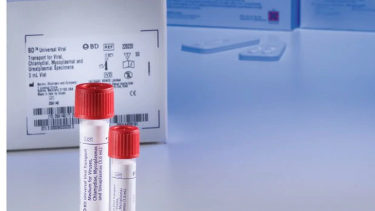 Virus test kit