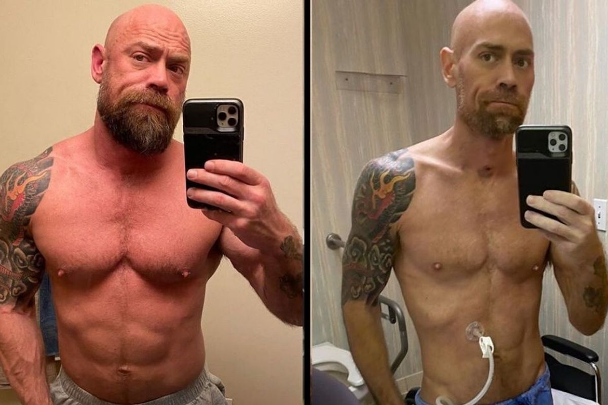 Nurse's photos show the drastic effects of his 8-week hospitalization with COVID-19