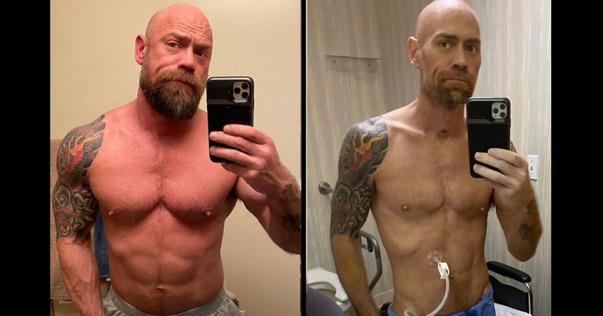 Nurse's photos show the drastic effects of his 8-week hospitalization with COVID-19