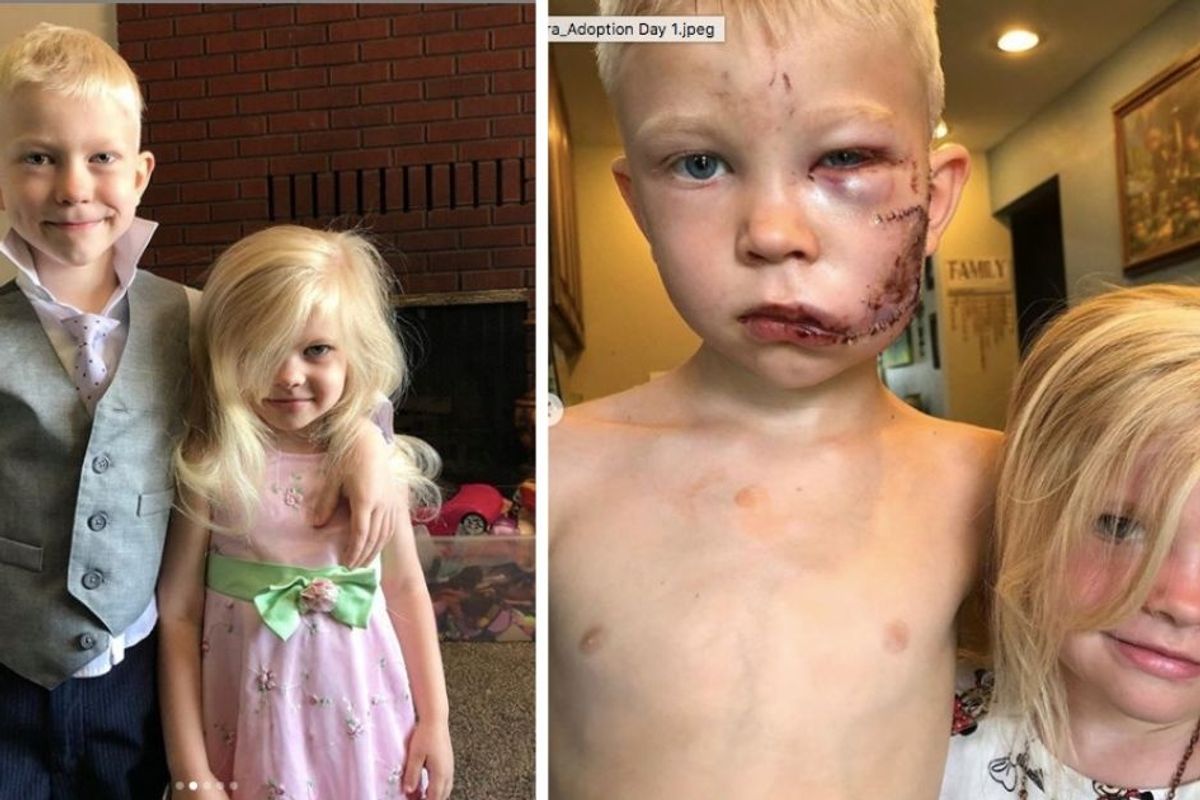6-year-old hero Bridger Walker selflessly saved his little sister from a dog attack