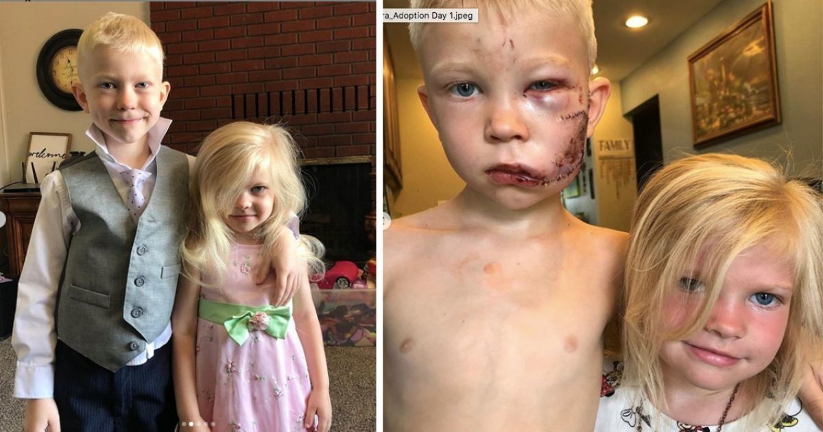 6-year-old hero Bridger Walker selflessly saved his little sister from a dog attack