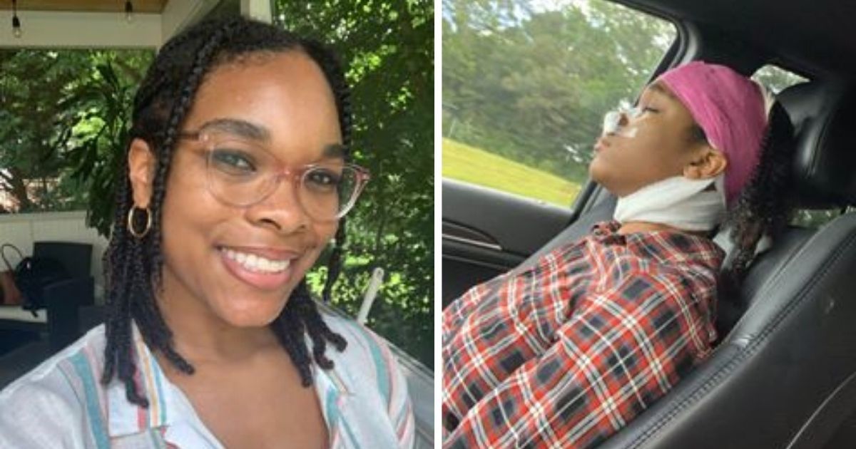 A Black woman came out of surgery with more braids than before