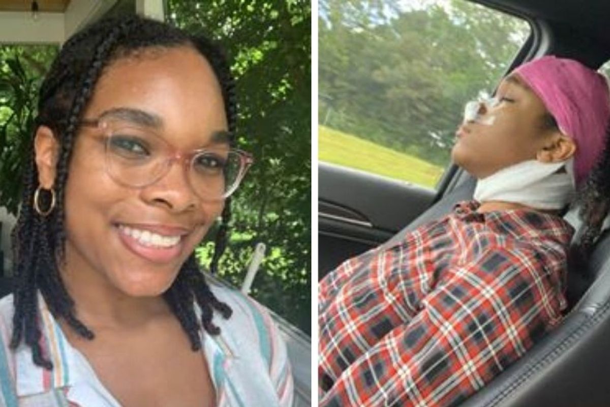 A Black woman came out of surgery with more braids than before. Here's why that matters.