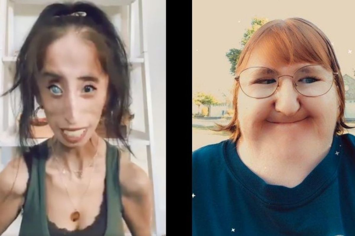 They were targeted by a cruel TikTok challenge. How they responded is an example to us all.