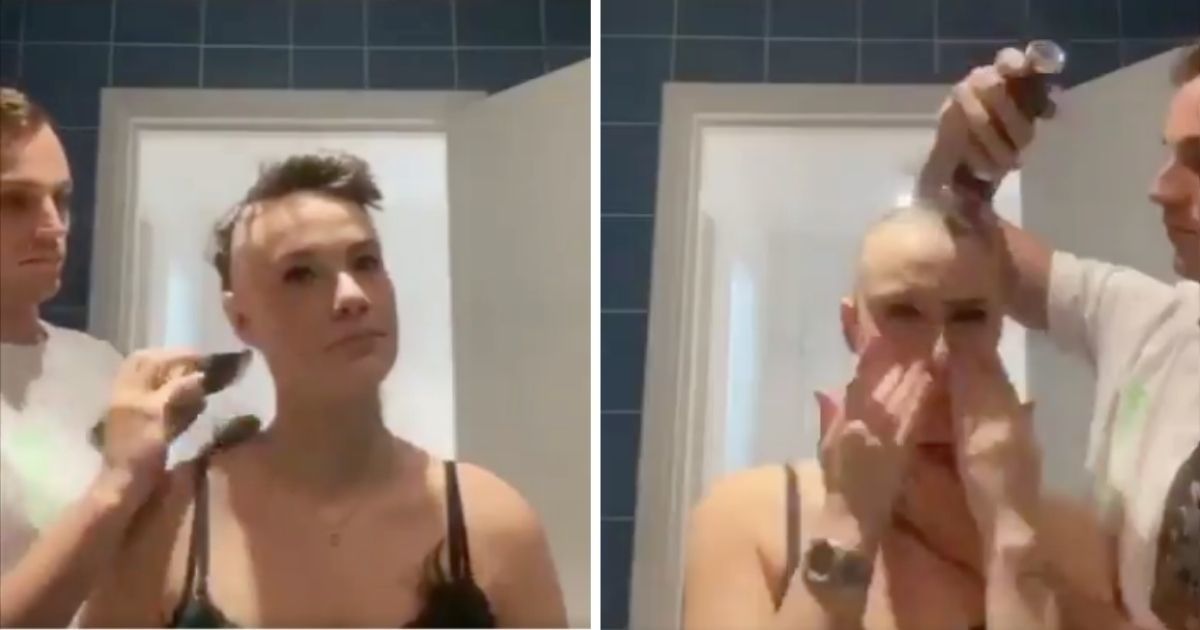Her boyfriend gently shaved her head after her alopecia diagnosis. But what he did next is so much better.