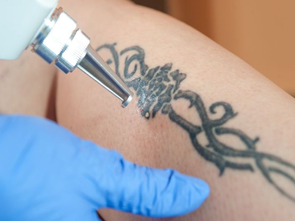 Bad Reaction From A New Tattoo Here S What To Do Consumer Health News Healthday