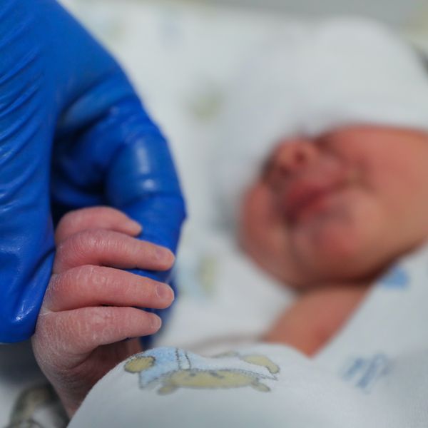Vegan parents neglected warnings that rigorous diet plan was unhealthy for their infant girl. She suffered mental retardation from the malnutrition. 1 img