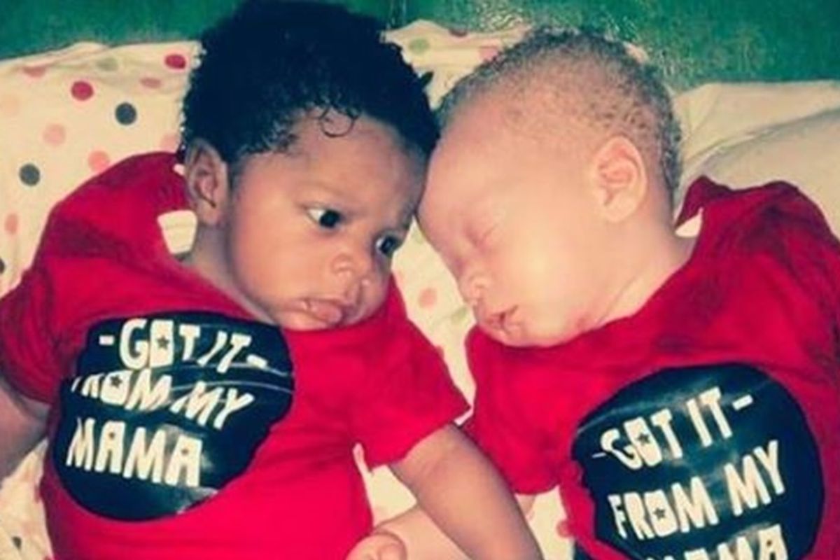 One's white. The other's black. But their mom wants you to know they're still identical twins.