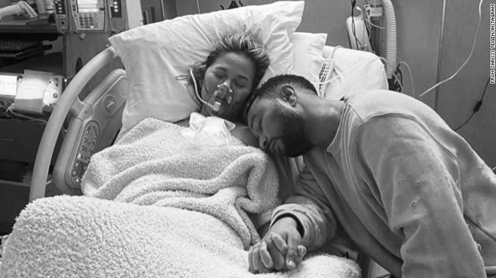 Chrissy Teigen’s Miscarriage Reminds Us That Everyone Grieves Differently, And That's OK