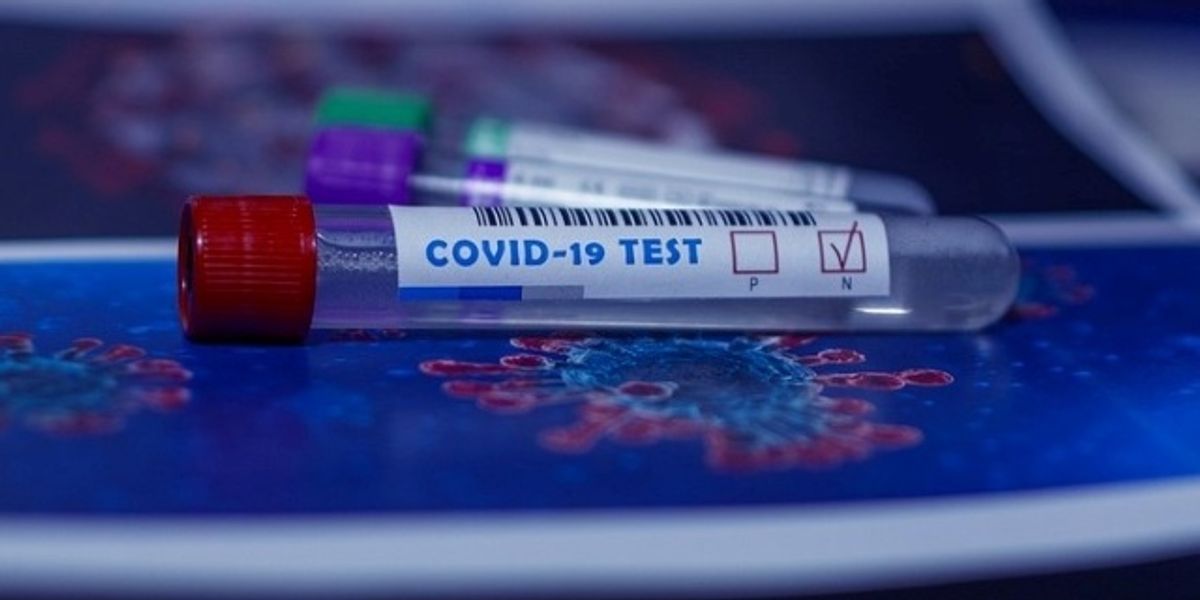 White House Has Lied For Months About COVID Testing Of Trump - Vimarsana News