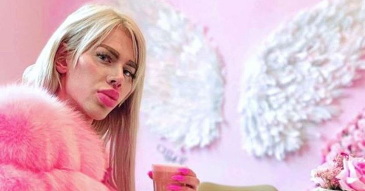 Man Has Nearly $20,000 Worth Of Fillers Injected Into His Face In Quest To 'Look Like Barbie'