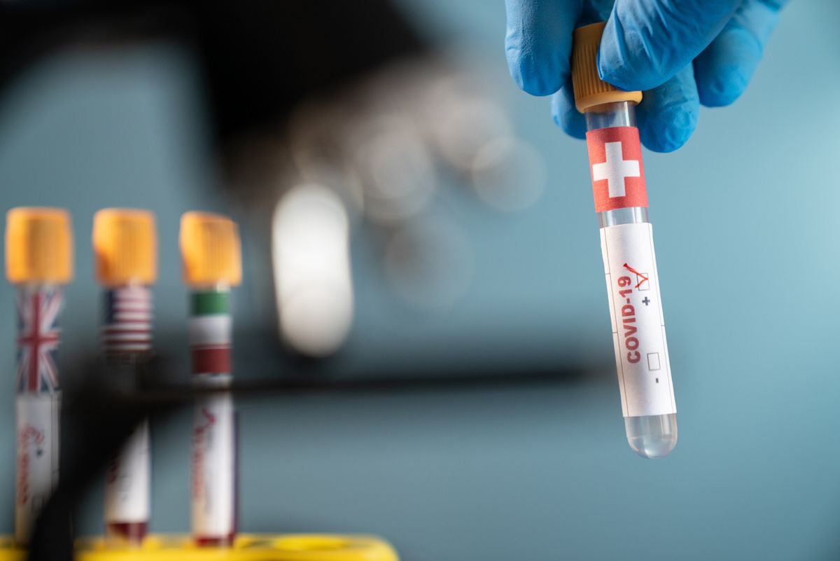 La Svizzera sta peggio, ma è immune all’isteria