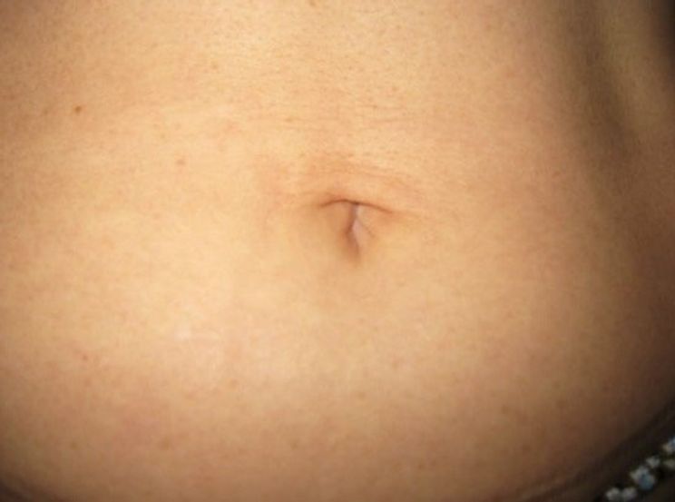 Here's the Real Reason You Have an Innie or an Outie Belly Button | 22 Words Here's the Real Reason You Have an Innie or an Outie Belly Button | 22 Words