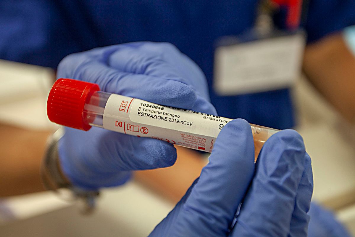 Tamponi gratuiti dai medici di base. «Ma i test rapidi non sono arrivati»
