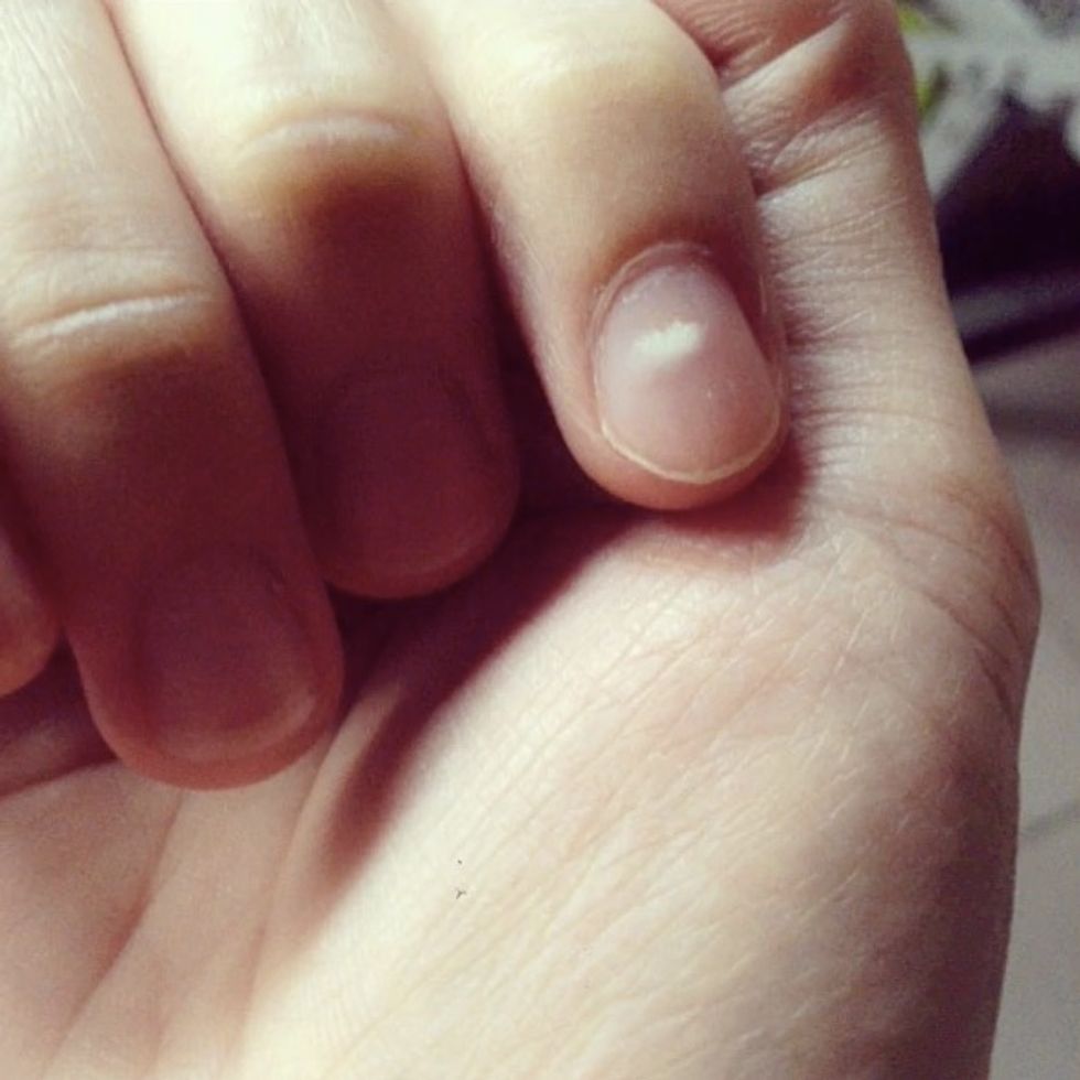 white-spots-on-your-nails-here-is-what-they-indicate