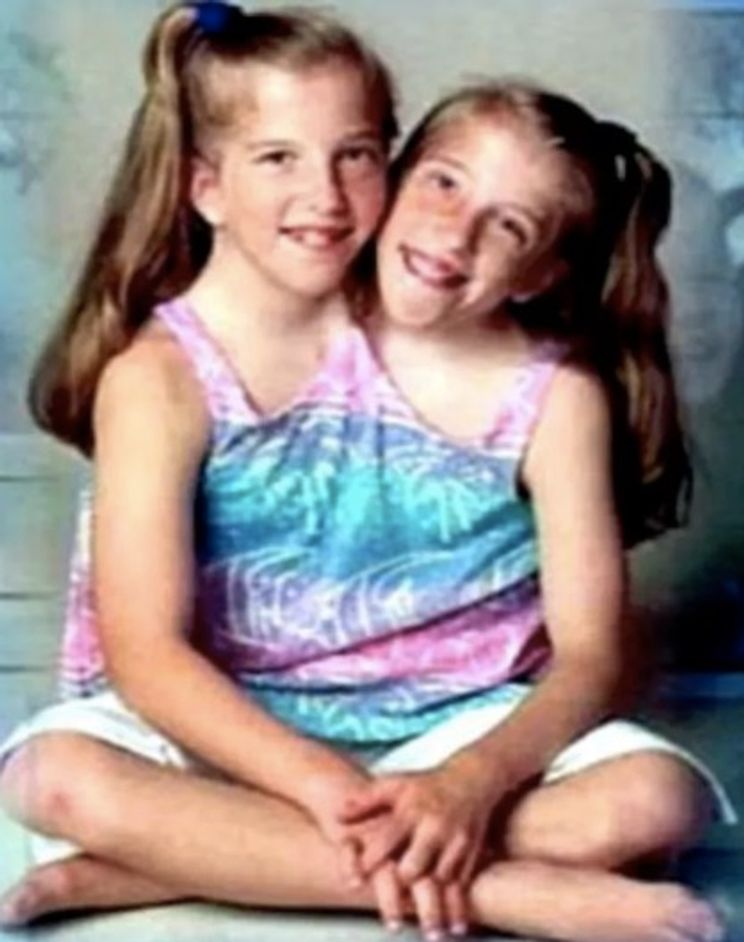 The Things You Ve Always Wanted To Ask Conjoined Twin Sisters Abby And Brittany 22 Words