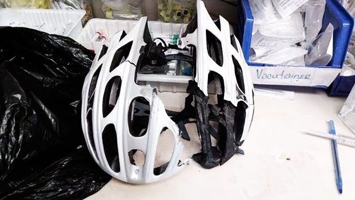 28 Shocking Photos Of Post Crash Helmets That Are Powerful Reminders To Img
