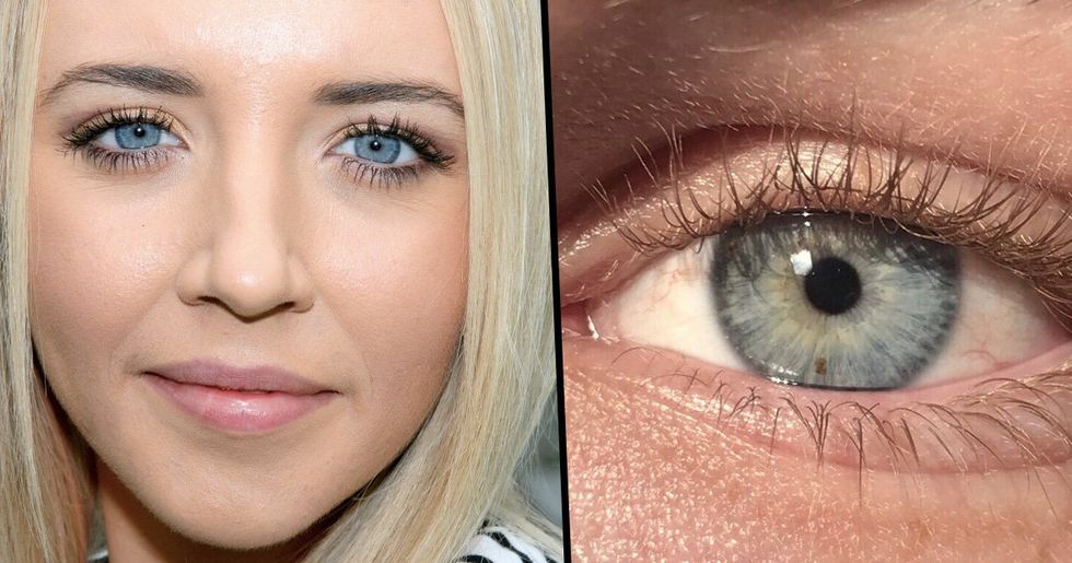 All People With Blue Eyes Have This One Thing In Common 22 Words