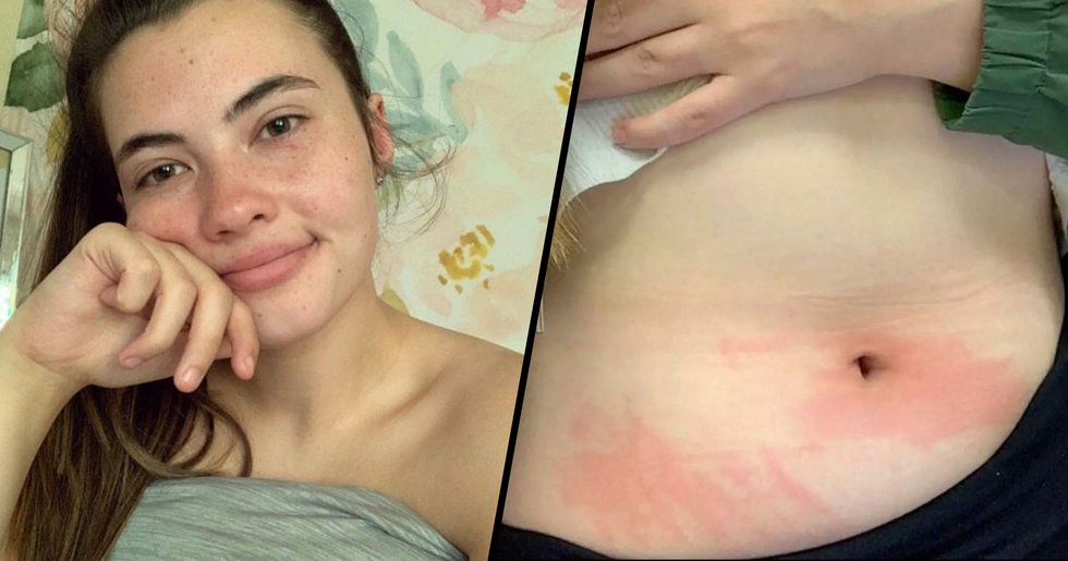 But There Are Definitely Some Allergies That Are More On The Bizarre Side 22 Words