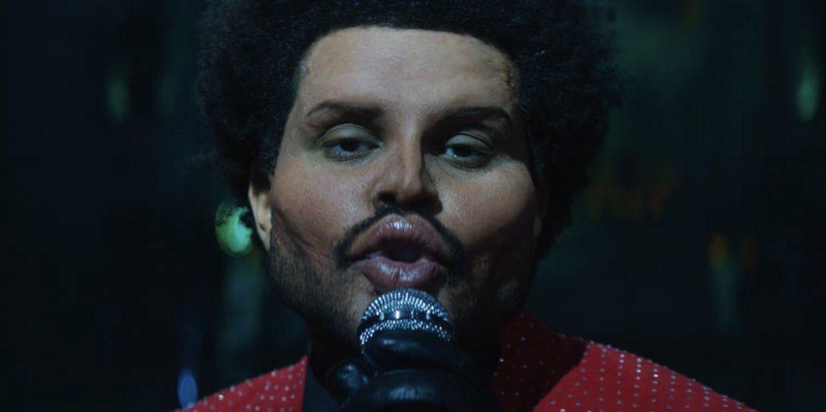 Why The Weeknd Has Been Bandaging His Face