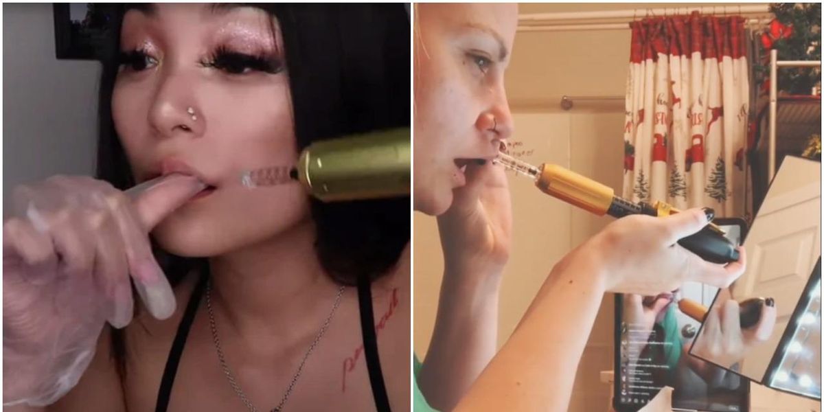 Experts Warn Against TikTok's DIY Lip Filler Trend