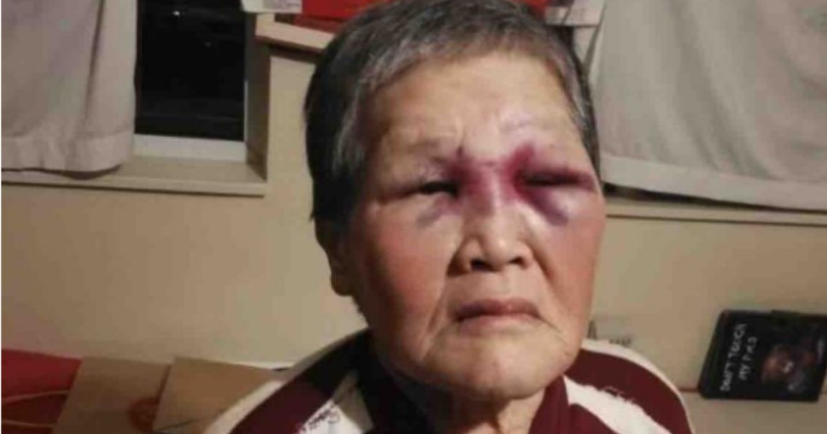 Asian Grandma Attacked In San Francisco Plans To Donate $900k Raised For Her To 'Combat Racism'