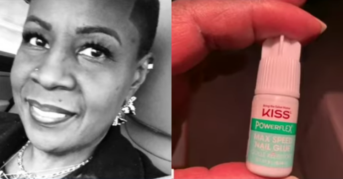 Woman Accidentally Seals Her Eye Shut After Sleepily Mistaking Nail Glue For Eye Drops