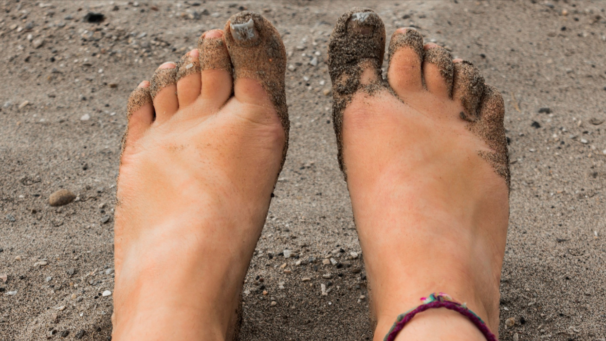 People Divulge The Worst Thing They've Ever Stepped On While Barefoot