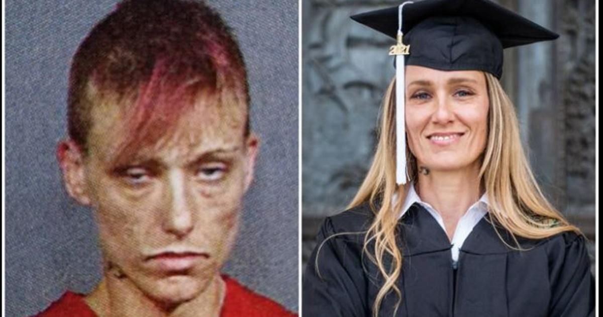 Woman shares startling before and after photo to give recovering addicts hope