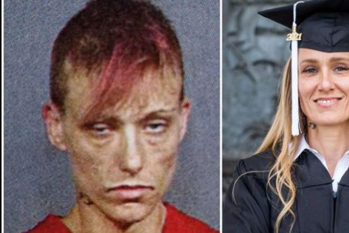 Woman shares startling before-and-after photo to give recovering addicts hope