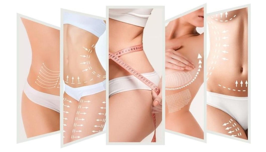 The Difference Between Lipo Laser and Liposuction