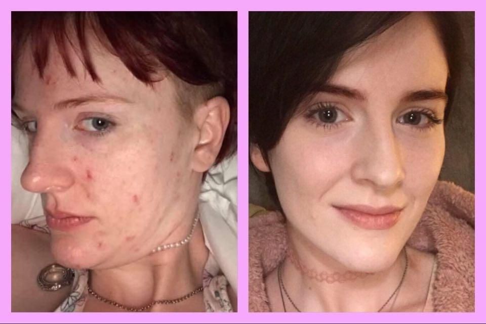 Our Editors Looked Into FLO Vitamins. Here’s What They Found Topdust