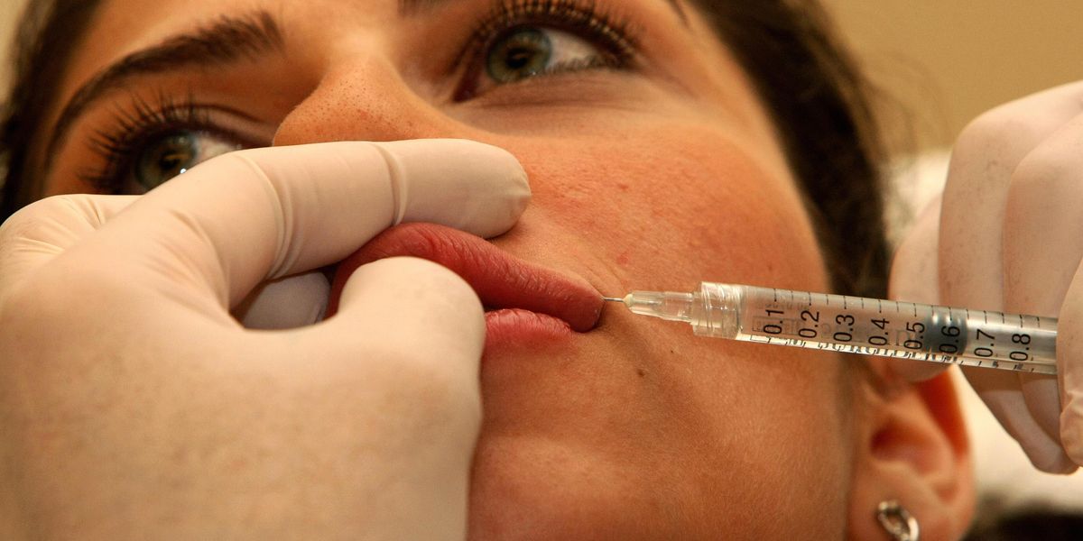 UK Politicians Want to Make Fillers Prescription Only
