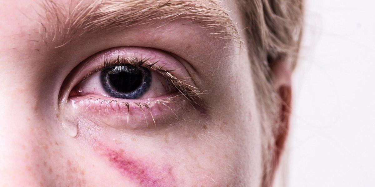 People Describe The Most Traumatizing Thing They Ever Experienced As A Child