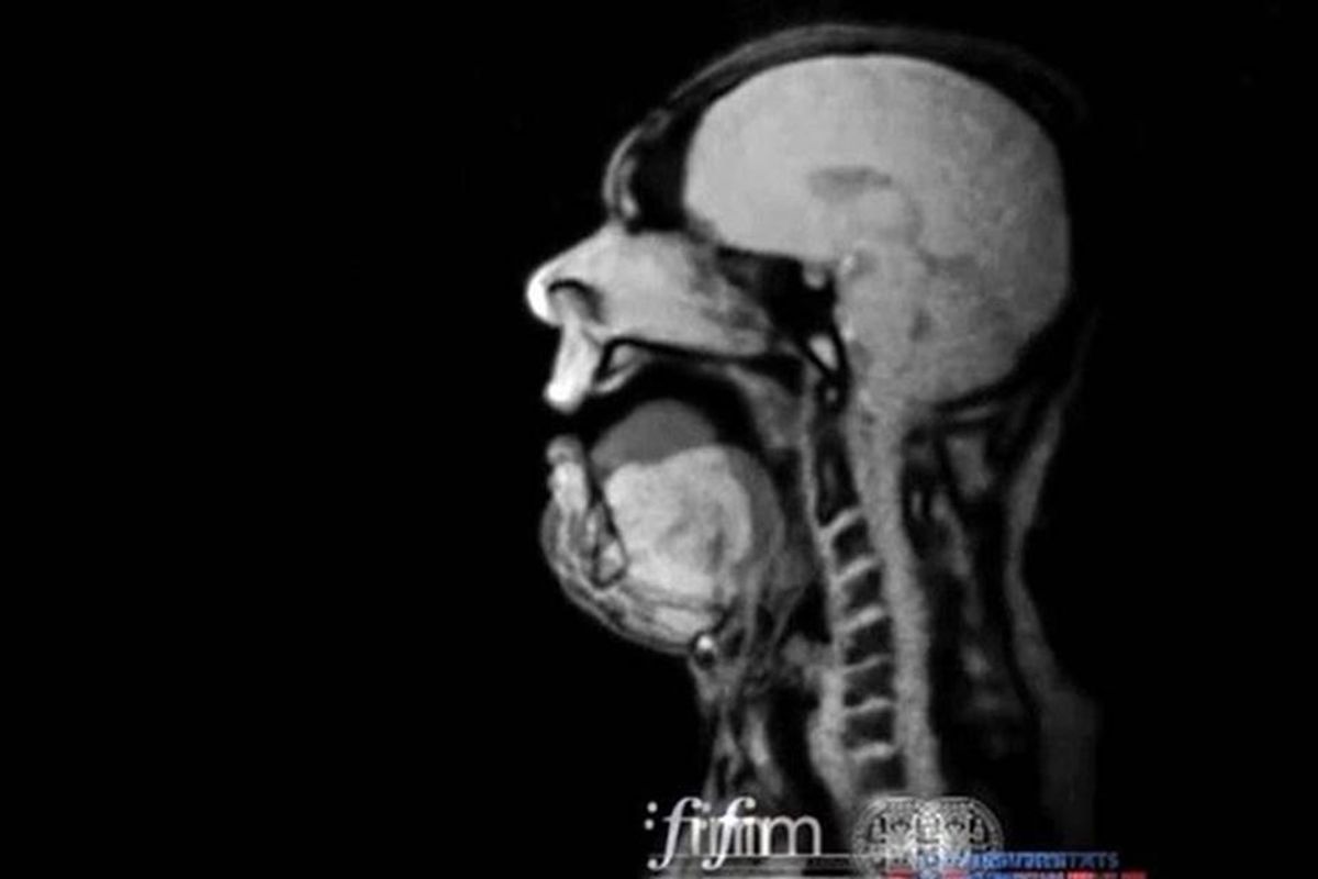An MRI Of opera singer Michael Voll performing Wagner