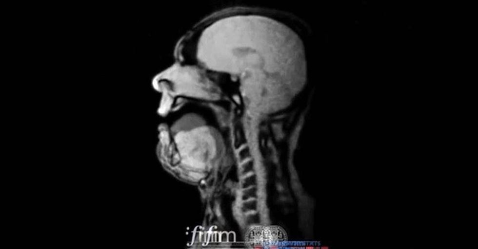 An MRI Of opera singer Michael Voll performing Wagner