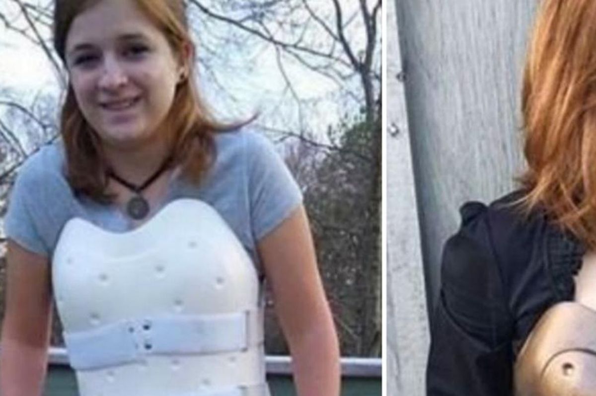 screenshot of teen girl in back brace