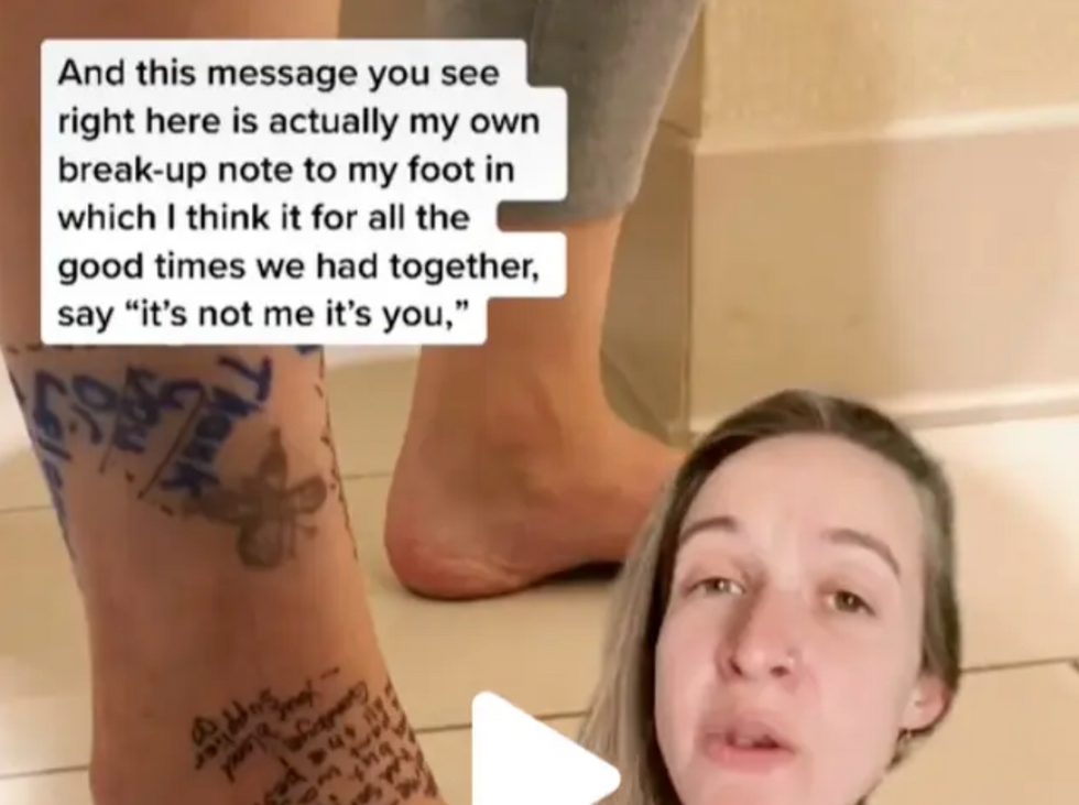 Woman shares breakup letter with her foot before amputation