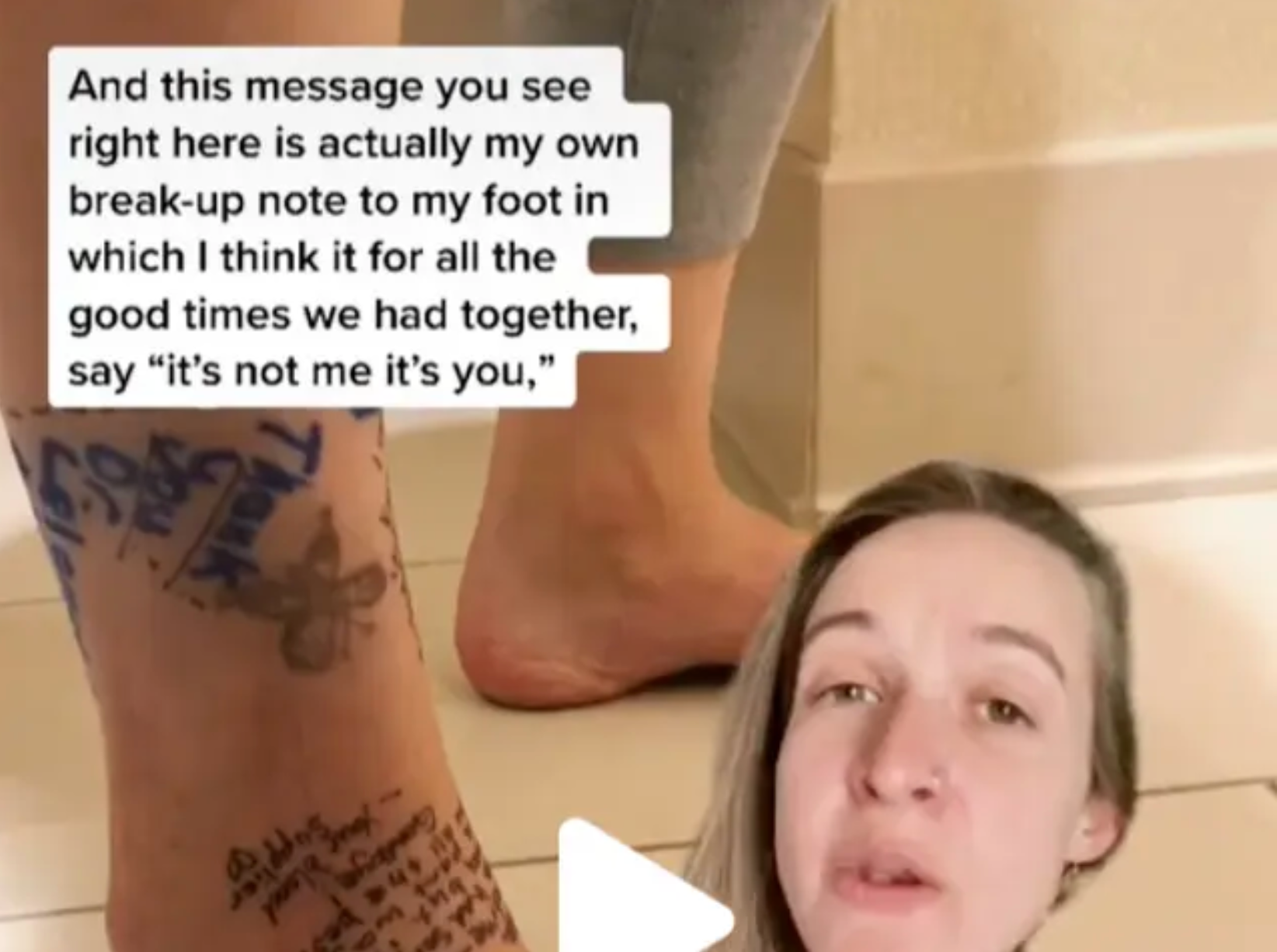 This woman wrote a startling breakup letter to her own foot before it was amputated