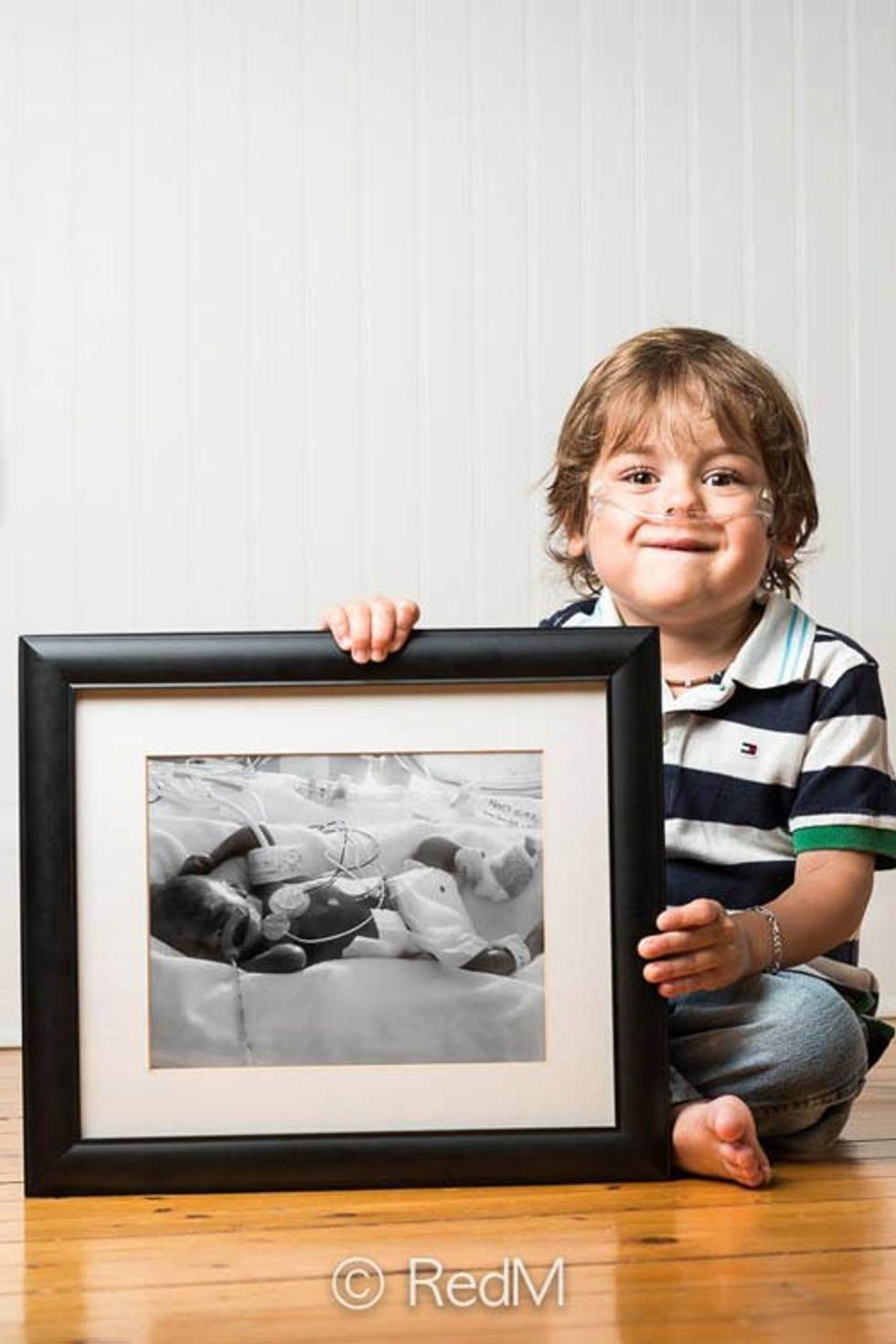 a little boy holds a black and white photograph of himself as a premature baby