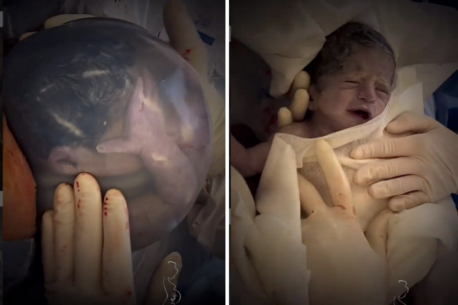 Doctor shares incredible video of baby born in the picture image