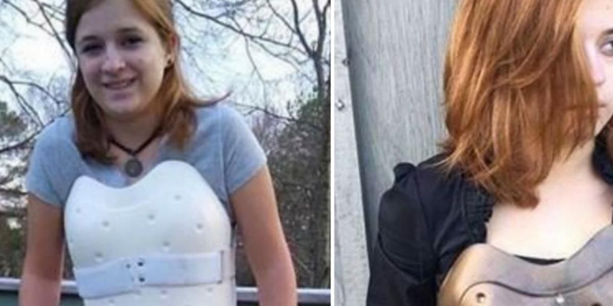This Girl Transformed Her Back Brace Into Steampunk Armor And It's So Sick