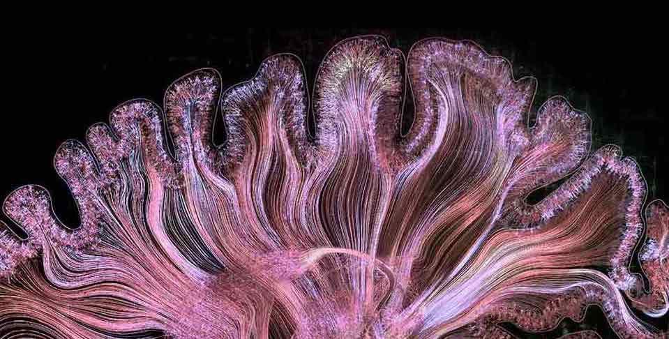 Can We Copy the Brain?