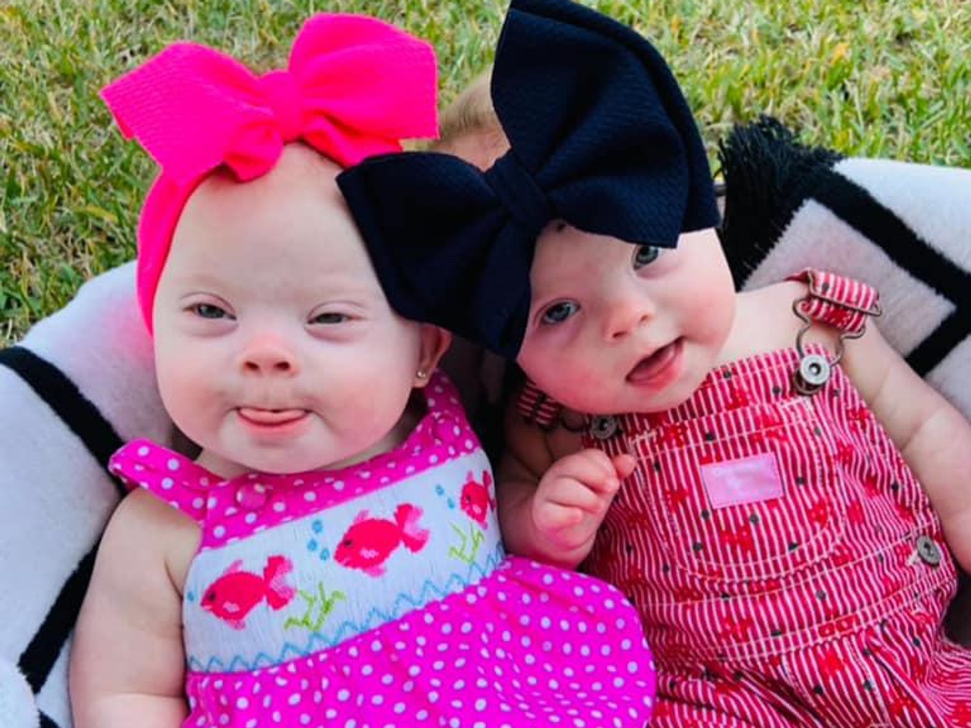 like-one-in-2-million-rare-twins-were-both-born-with-down-syndrome