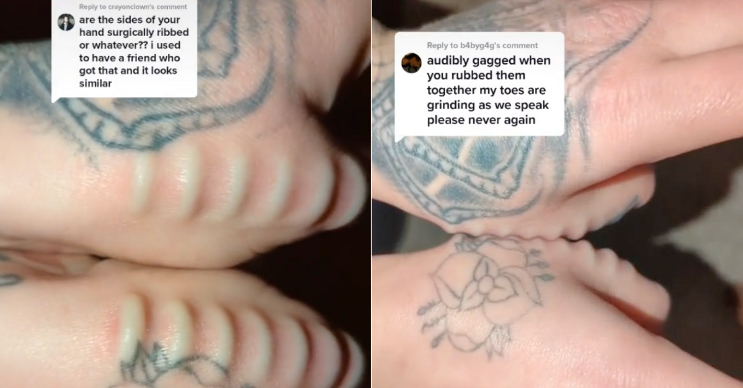 Woman Shows Off Silicone Implants On Her Thumbs She Rubs Together Like A 'Weird Fidget Toy'