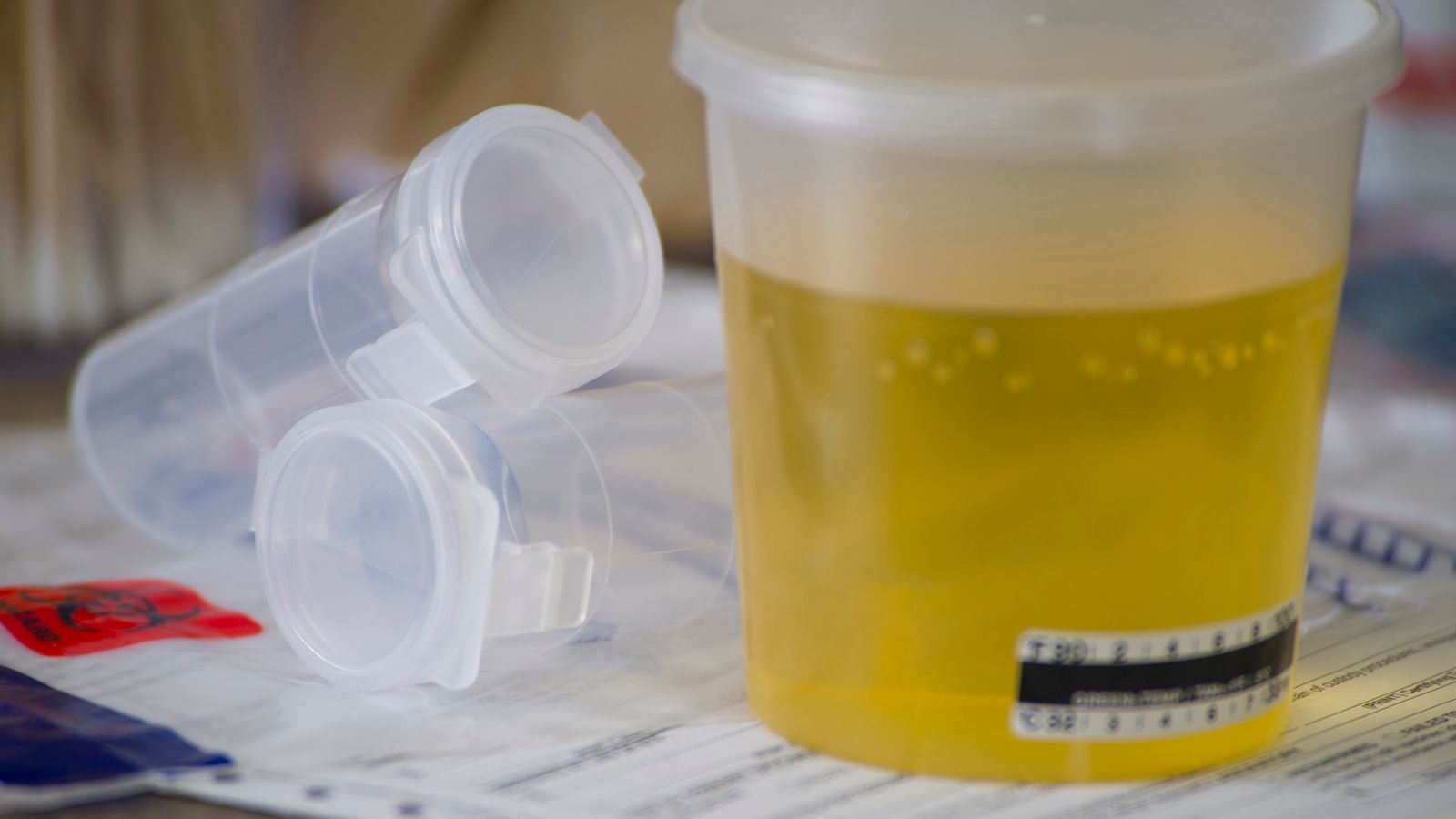 Follow-up alcohol and drug testing - Motor Carrier