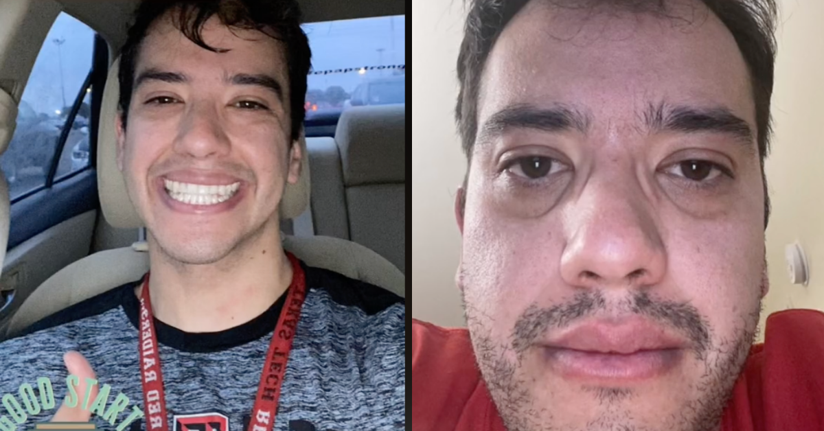 Med Student's Before And After Photos Show The Noticeable Toll It's Taken On His Appearance