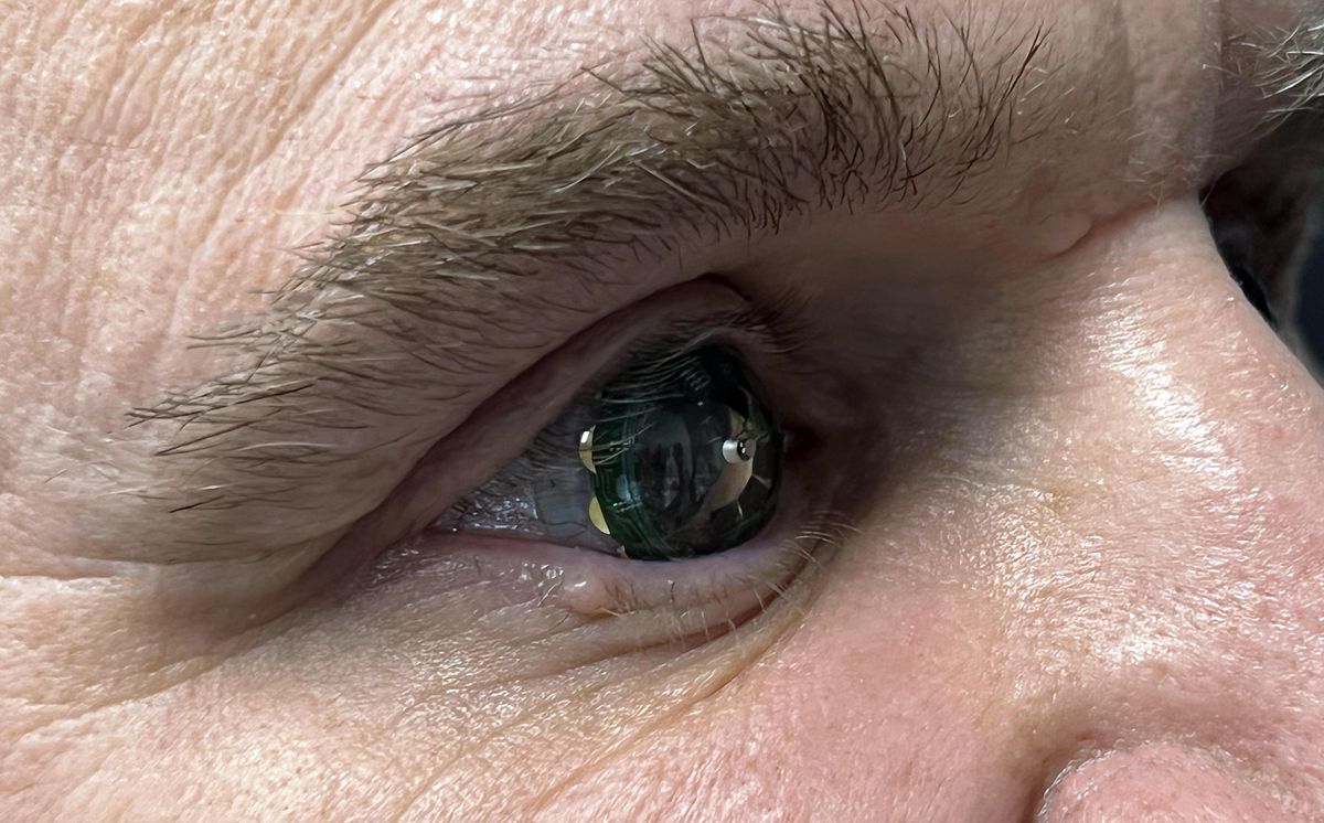 Mojo Vision Puts AR Contact Lens Into Its CEO’s Eyes