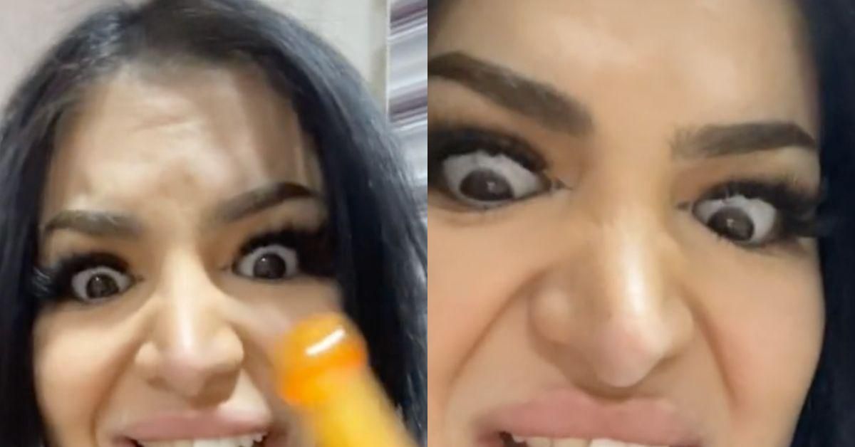 Woman Warns TikTok Not To Get Veneers Done Abroad 'On A Whim' After Nightmare Experience