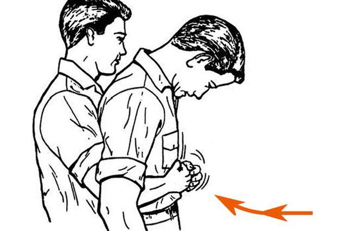 heimlich maneuver, david diaz, choking